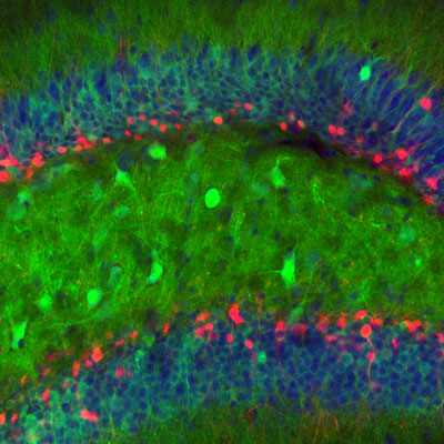 Снимок из пресс-релиза Scientists Watch Activity of Newborn Brain Cells in Mice; Reveal they are Required for Memory; «новорожденные» нейроны окрашены красным – ВМ.