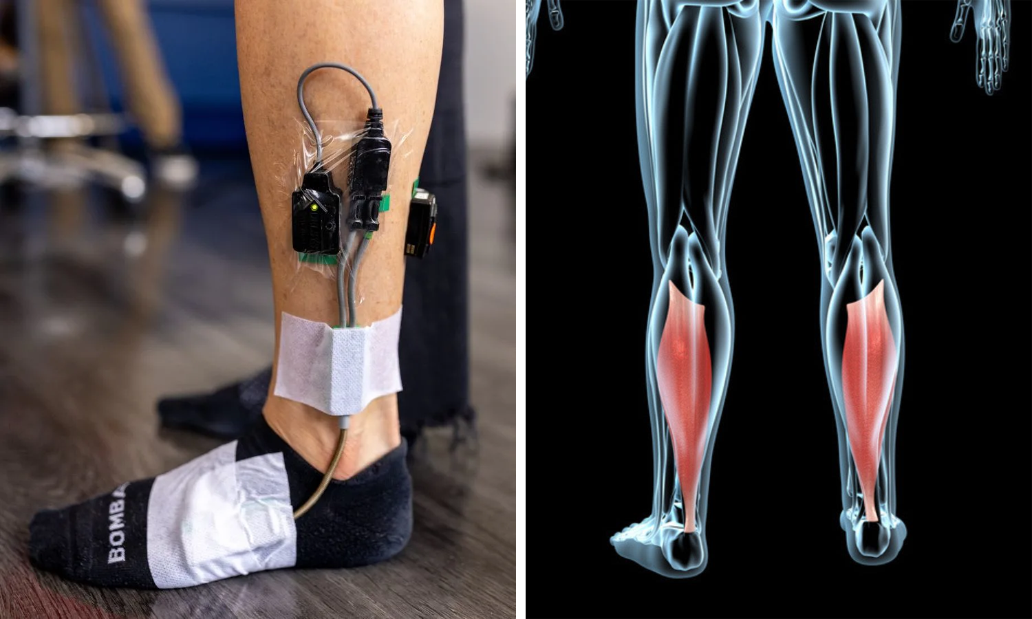 soleus1.png soleus1.png