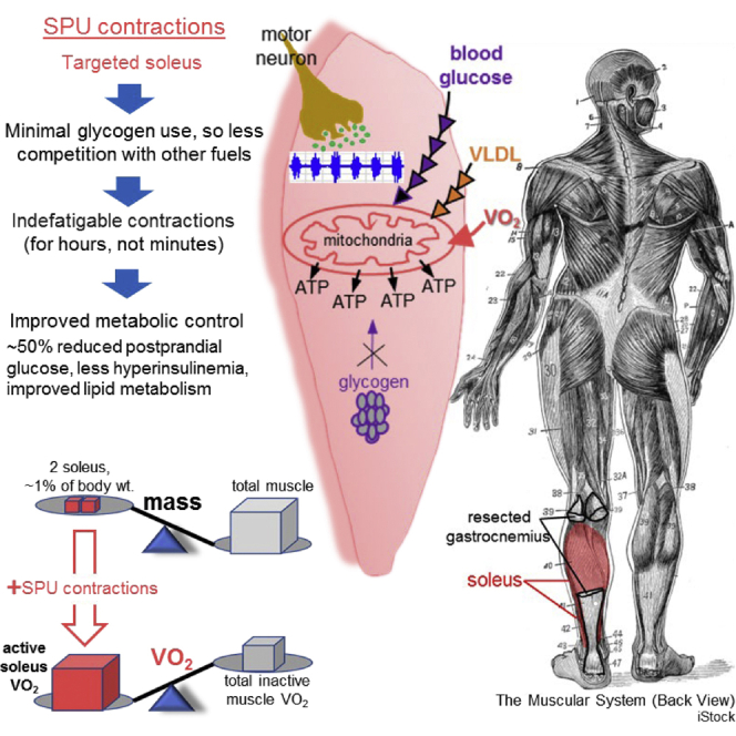 soleus2.jpg soleus2.jpg