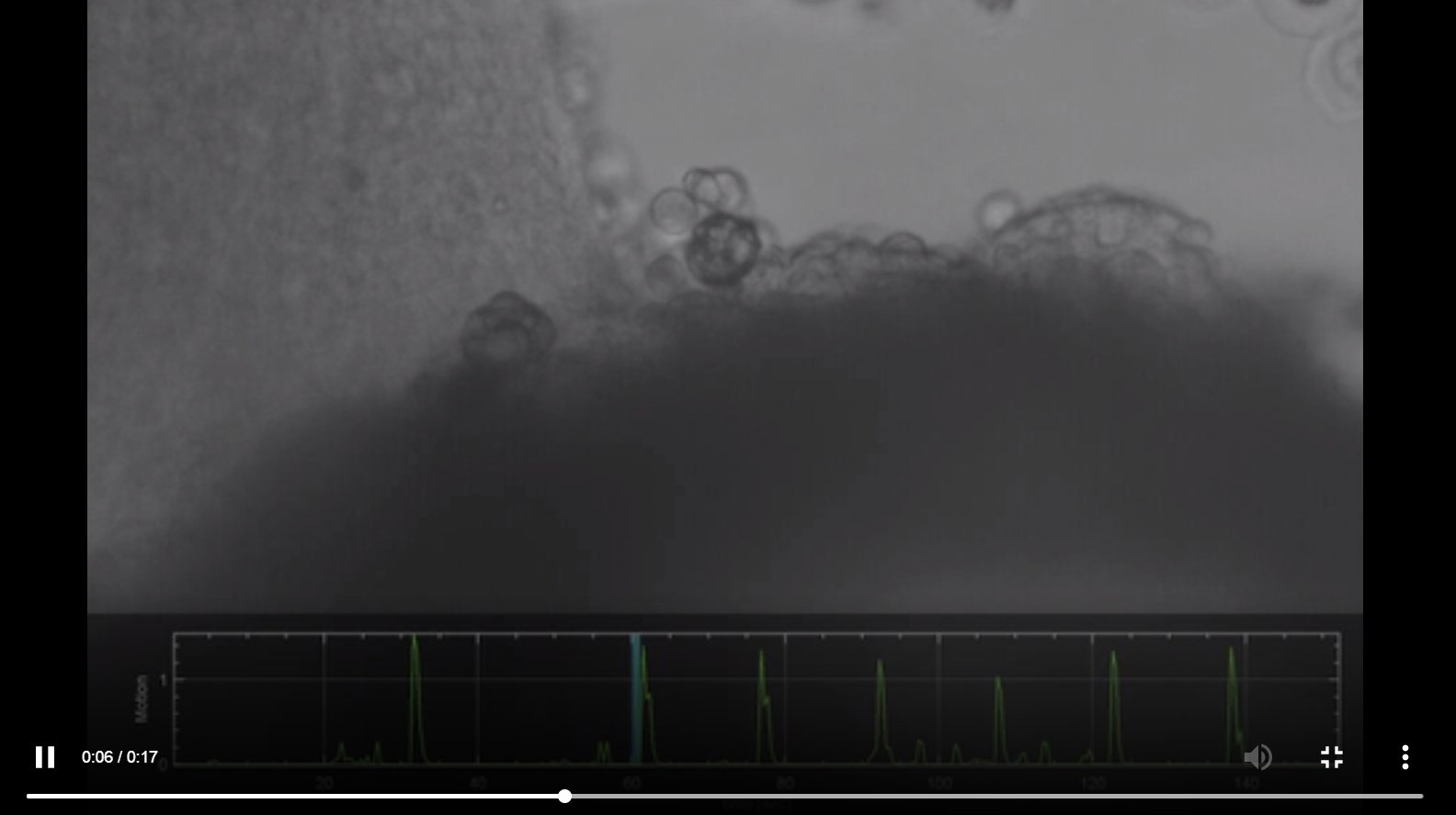 Movie of evoked muscle contractions. The brain organoid is stimulated at regular intervals, sending a signal to the spinal cord, which relays the information to the muscle to make it contract